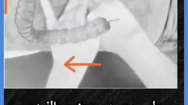 طب الصيني